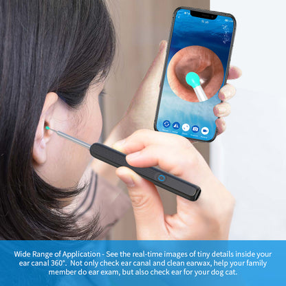 Nettoyant Otoscope oreille avec caméra LED, Kit pour i-phone