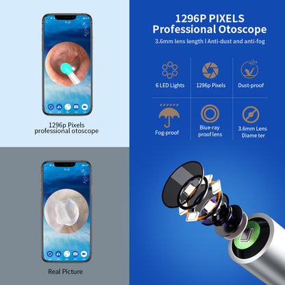 Nettoyant Otoscope oreille avec caméra LED, Kit pour i-phone